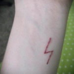 Фото тату молния на шраме 14.09.2019 №003 - scar lightning tattoo - tatufoto.com