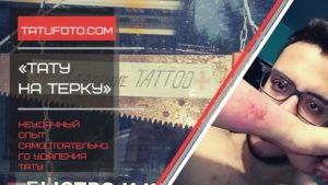 Фото неудачного удаления татуировки лазером. Видны ожоги, шрамы и покраснение кожи. Предупреждение о рисках самостоятельного удаления тату.