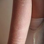 Фото белой татуировки, покрывающей большую часть руки. Сложный орнамент с растительными мотивами и геометрическими узорами, выполненный в технике белых чернил.