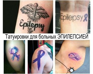 Фото тату: коллаж из нескольких татуировок, посвященных эпилепсии. Изображены ленты, медицинские символы и надписи 'Epilepsy'.