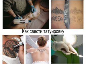 Коллаж из нескольких фотографий, демонстрирующих процесс удаления татуировки лазером: обработка лазером, рука мастера в перчатках, до и после удаления.