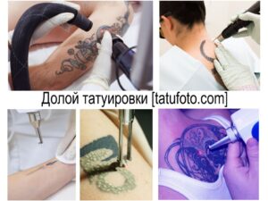Фото тату коллаж, демонстрирующий процесс удаления различных татуировок лазером на разных частях тела.