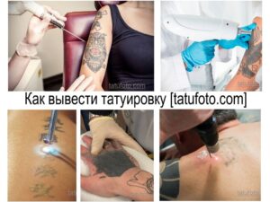 Фото процесса удаления татуировки лазером на коже. Видны этапы воздействия аппаратом, изменения кожи и примеры татуировок до и после процедуры.