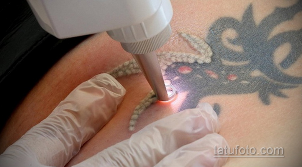 Фото пример выведения татуировки 31.05.2020 №1002 - tattoo- tatufoto.com