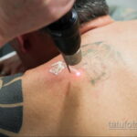 Фото пример выведения татуировки 31.05.2020 №1010 - tattoo- tatufoto.com