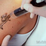 Фото пример выведения татуировки 31.05.2020 №1012 - tattoo- tatufoto.com