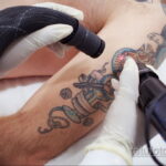 Фото пример удаления татуировки 31.05.2020 №011 - tattoo- tatufoto.com