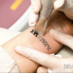 Фото пример удаления татуировки 31.05.2020 №015 - tattoo- tatufoto.com