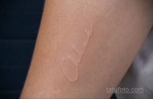 Фото пример белой татуировки 24.09.2020 №029 -white tattoo- tatufoto.com