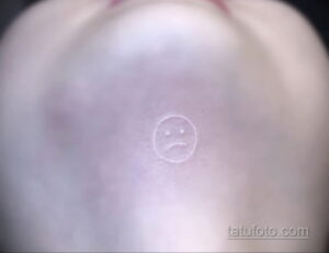 Фото пример белой татуировки 24.09.2020 №038 -white tattoo- tatufoto.com