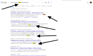 Скриншот страницы результатов поиска Google по запросу 'методы лечения анагенной алопеции'. Отображаются ссылки на различные медицинские статьи и сайты.