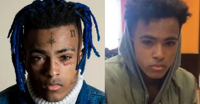 XXXTentacion (Джасей Дуэйн Рикардо Онфрой) – до и после нанесения татуировок - фото