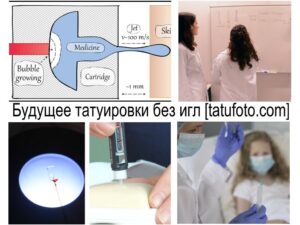 Фото тату демонстрирует инновационную технологию нанесения татуировок без использования игл, с использованием лазерного луча.