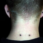 Фото Хрящевой пирсинг 29.01.2021 №0096 - Cartilage piercing - tatufoto.com