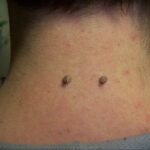 Фото Хрящевой пирсинг 29.01.2021 №0105 - Cartilage piercing - tatufoto.com
