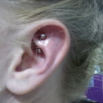 Фото Хрящевой пирсинг 29.01.2021 №0183 - Cartilage piercing - tatufoto.com
