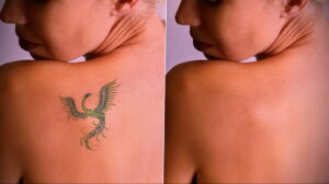 Как вывести татуировку в салоне и дома - tatufoto.com 10022021 фото - 10