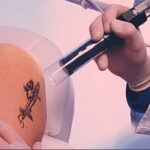 Как вывести татуировку в салоне и дома - tatufoto.com 10022021 фото - 11
