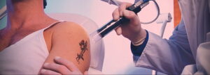 Как вывести татуировку в салоне и дома - tatufoto.com 10022021 фото - 11