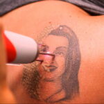 Как вывести татуировку в салоне и дома - tatufoto.com 10022021 фото - 14