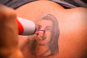 Как вывести татуировку в салоне и дома - tatufoto.com 10022021 фото - 14