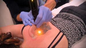 Как вывести татуировку в салоне и дома - tatufoto.com 10022021 фото - 16