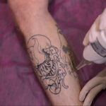 Как вывести татуировку в салоне и дома - tatufoto.com 10022021 фото - 17