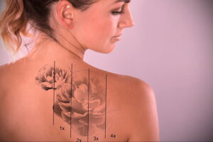 Как вывести татуировку в салоне и дома - tatufoto.com 10022021 фото - 5