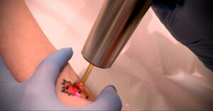Как вывести татуировку в салоне и дома - tatufoto.com 10022021 фото - 6