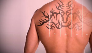 Как вывести татуировку в салоне и дома - tatufoto.com 10022021 фото - 7
