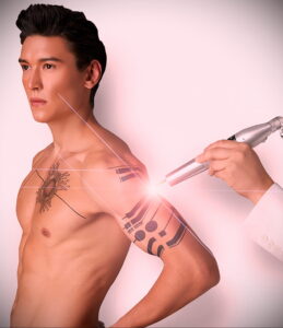 Как вывести татуировку в салоне и дома - tatufoto.com 10022021 фото - 9