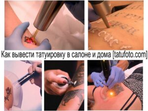 Коллаж фотографий, демонстрирующих различные методы удаления татуировок: лазерное удаление, хирургическое иссечение и химический пилинг.