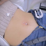 Фото пирсинга пупка - прокол пупка 17.03.2021 №094 - belly button piercing - tatufoto.com
