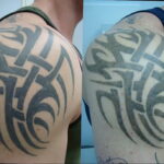 Фото старения татуировки 15.03.2021 №031 - aging tattoo - tatufoto.com