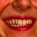 Фото рисунка тату на зубе 07,11,2021 - №0005 - tattoo on the tooth - tatufoto.com