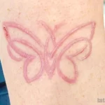 Фото шрамирование 01,12,2021 - №0009 - scarification - tatufoto.com