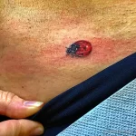 Фото тату Божья Коровка 17.02.22 №0047 - tattoo Ladybug tatufoto.com