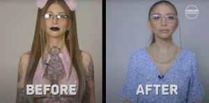 Фотография до и после удаления татуировок с рук и груди девушки. Демонстрация эффективности процедуры удаления тату.