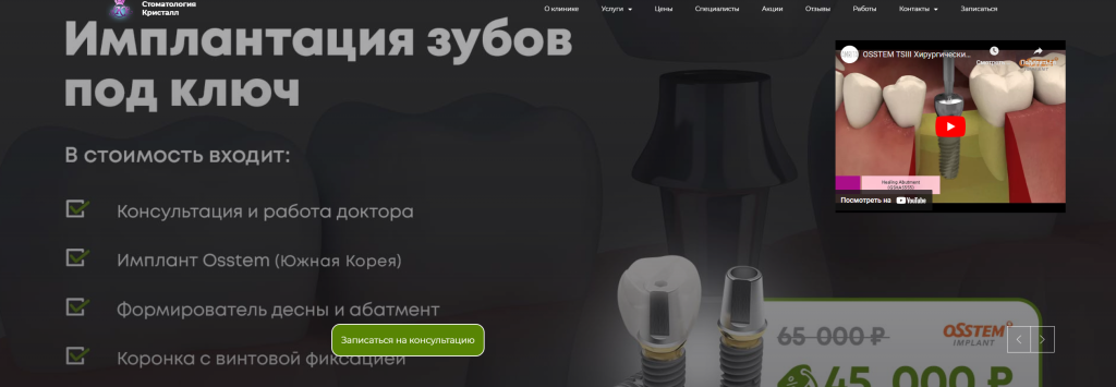 Виниры - преобразуйте свою улыбку с помощью индивидуальной эстетики - картинка для статьи tatufoto.com 11072023