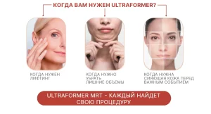 Collage showing three faces demonstrating the effects of ultrasound lifting: lifting, volume reduction, and skin radiance. Ideal for those seeking non-surgical rejuvenation.