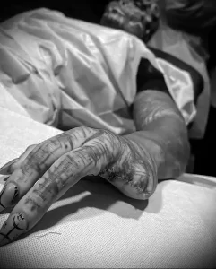 Фотография руки мужчины, покрытой черно-белыми татуировками с изображением узоров и абстрактных форм.