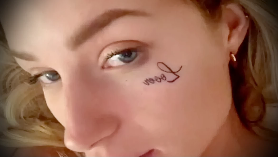 Лотти Мосс избавляется от татуировки на лице - фото для tatufoto.com 20062024 1