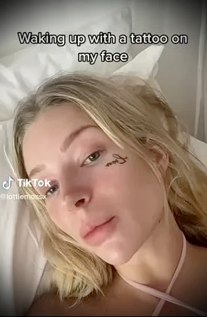 Лотти Мосс избавляется от татуировки на лице - фото для tatufoto.com 20062024 3