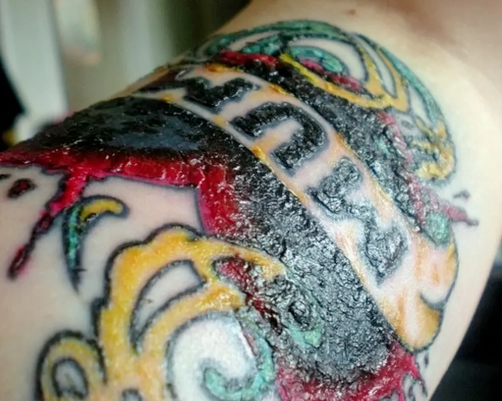 КАКИЕ ФАКТОРЫ ВЛИЯЮТ НА ЗАЖИВЛЕНИЕ ТАТУИРОВКИ 13 - 290824 tatufoto.com 13
