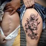 Можно ли сделать татуировку на рубце 1 - 230824 tatufoto.com 01
