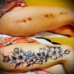 Можно ли сделать татуировку на рубце 10 - 230824 tatufoto.com 10