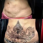 Можно ли сделать татуировку на рубце 15 - 230824 tatufoto.com 15