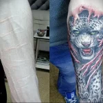 Можно ли сделать татуировку на рубце 16 - 230824 tatufoto.com 16