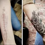 Можно ли сделать татуировку на рубце 18 - 230824 tatufoto.com 18