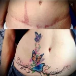 Можно ли сделать татуировку на рубце 2 - 230824 tatufoto.com 02